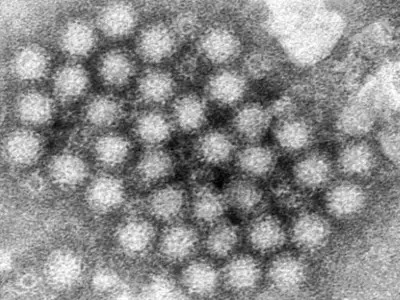 What to know about norovirus after suspected outbreak closes Medford elementary school closed for second day